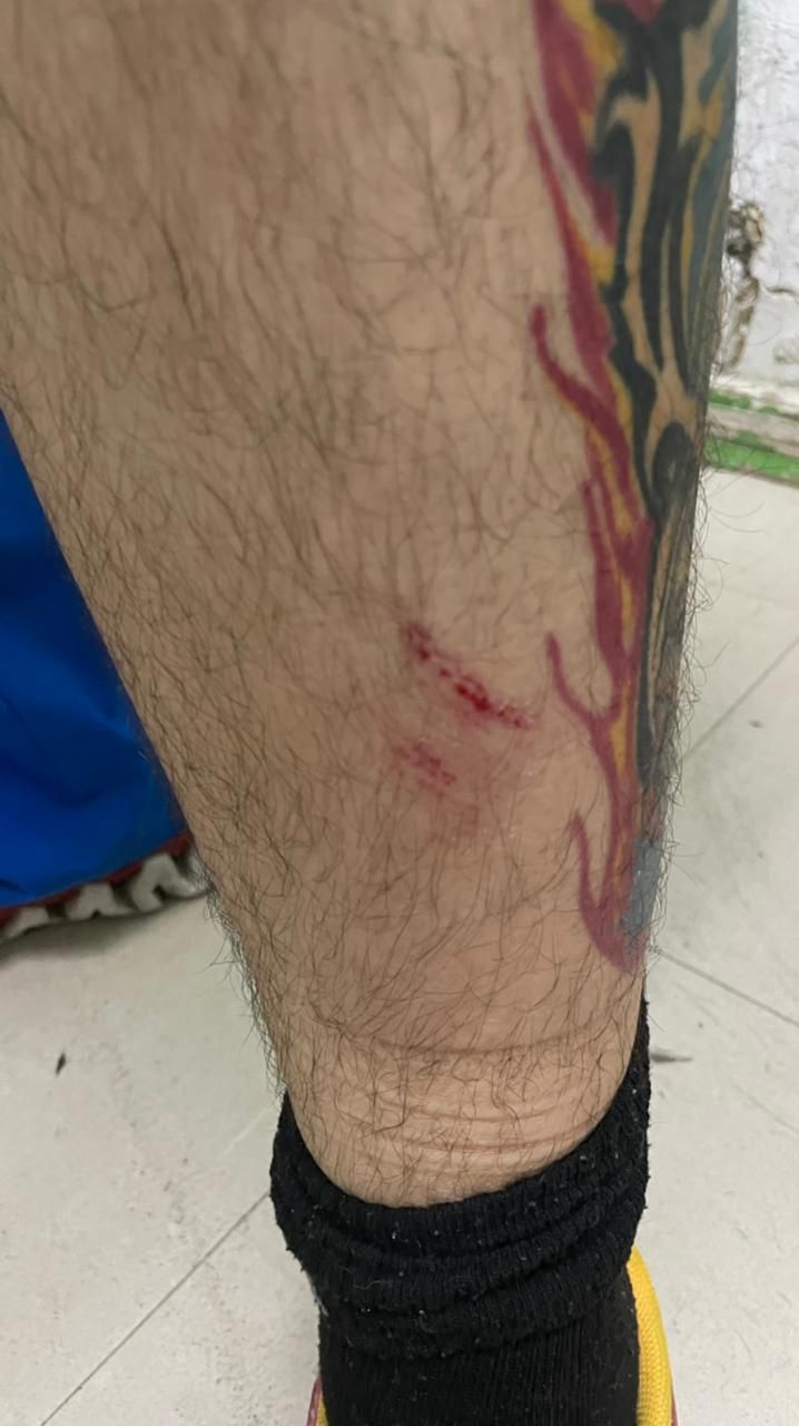 SAN FELIPE: Hospital San Camilo condena violenta agresión a cuatro funcionarios de Urgencia 2 SAN FELIPE: Hospital San Camilo condena violenta agresión a cuatro funcionarios de Urgencia